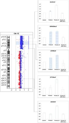 A case report of Pallister-Killian syndrome with an unusual mosaic supernumerary marker chromosome 12 with interstitial 12p13.1-p12.1 duplication